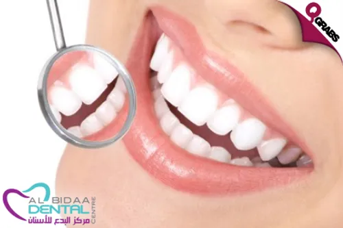 From QR189 Get a Mouth Examination and either Teeth Scaling & Polishing OR a Home Bleaching Kit! (Up to QR1650 Value)